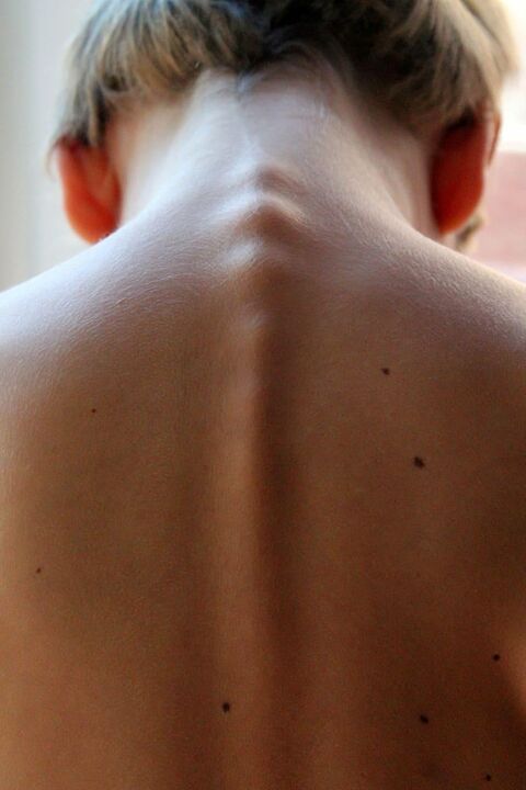 spines