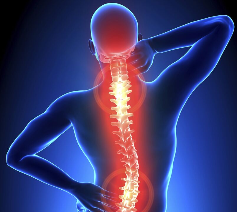 Osteocondrosis of the spine
