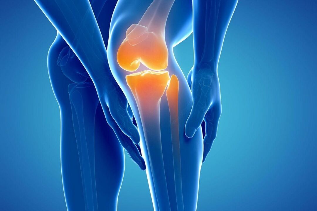 What is Arthroz